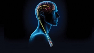 How to find Best deep brain stimulation surgery in Mumbai