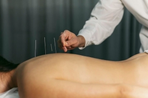 What is Acupuncture? Understanding Its Benefits in Yonkers