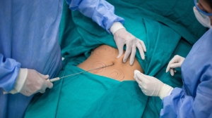 Can You Reverse Bariatric Surgery? Pros and Cons