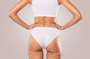 What Are Patient Reviews for Thigh Lift Surgery in Riyadh?