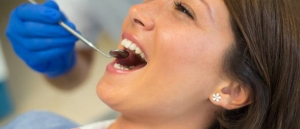 Why Choose Metal-Free Fillings in Issaquah? Benefits You Should Know