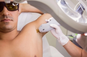 LinScan Laser Hair Reduction: A Safe and Effective Solution for Darker Skin in Delhi
