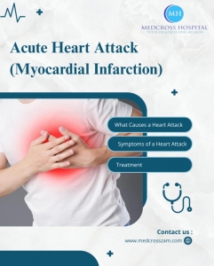 Acute Heart Attack (Myocardial Infarction): Causes, Symptoms, and Treatment in Zambia
