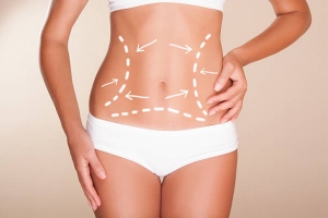 How Effective Is Liposuction for Weight Reduction in Riyadh?