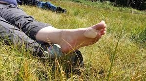 How to Treat Blisters from Scottish Hikes