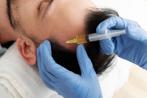 What Is PRP Treatment and How It Works in Manchester