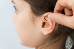 Are Children Eligible for Otoplasty Surgery?