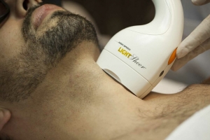 Laser Hair Removal: Results After the First Session
