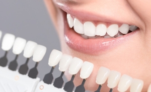 The Truth About Dental Veneers: Myths, Facts, and How to Get the Best Results