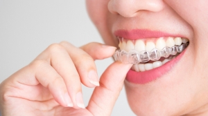 Comparing Invisible Braces Options: InBrace, Clear Aligners & Hybrid Treatments