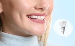 Dental Implants and Oral Health: How They Improve Overall Well-being