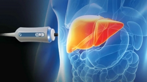 Protect Your Health with Liver Disease Screening in San Antonio, TX