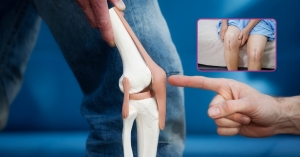 Humidity and Joint Pain: Expert Advice from a Leading Orthopaedic Surgeon in Delhi