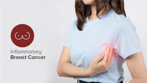 Why is Inflammatory Breast Cancer so aggressive and fast-growing
