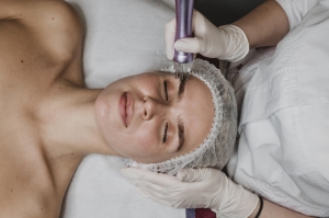 Microneedling Treatment UK: Before & After Care Tips You Need to Know