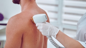 Laser Hair Removal 101: Shaving vs. waxing. Laser -Which Hair Removal Method wins?
