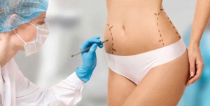 The Science Behind Liposuction in Islamabad