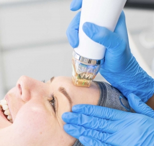 Fractional RF Microneedling Turns Dull Skin Into Radiance