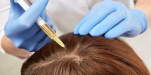 Combat Hair Loss Naturally with Platelet Rich Plasma Treatment Delhi