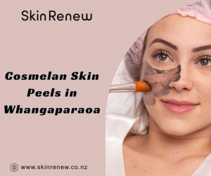 Everything You Should Know About Cosmelan Skin Peels in Whangaparaoa