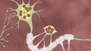 Krabbe Disease Market Size, Trends, and Growth Forecast 2025-2032