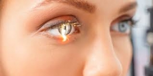 Refractive Surgery - Restore Clear Vision WithoutGlasses
