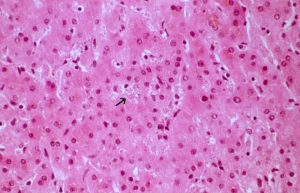 Visceral Leishmaniasis Market Dynamics: Regional Insights and Forecast Analysis