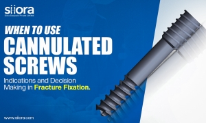When to Use Cannulated Screws: Indications and Decision-Making in Fracture Fixation.