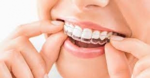 Getting Started with Invisalign: Your Guide to Straightening Your Teeth