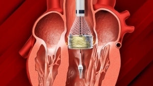 Cardiac Ablation Devices Market Size, Trends, and Growth Forecast 2025-2032