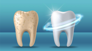 What is Enamel? Benefits, Protection Tips, and a Dentist’s Perspective