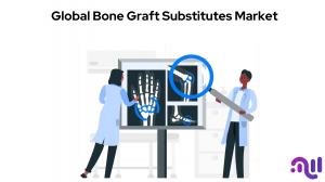Building Strong Foundations: The Growing Market for Bone Graft Substitutes