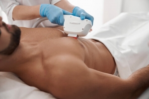 How to Prepare for Laser Hair Removal in Islamabad for Best Results