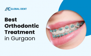 Exploring Different Types Of Braces Treatment Options 