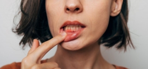 woman looking at her gums