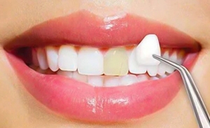 How to select the best dentist near Laurel, MD for oral health
