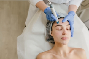 Achieve Brighter, Even-Toned Skin with IPL Photofacial in Corpus Christi TX