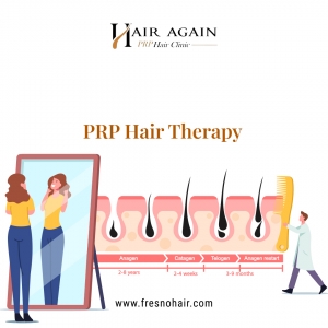 Regain Confidence with Platelet Rich Plasma Hair Therapy in Fresno