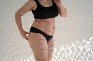 Body Sculpting in Scottsdale: Non-Surgical Solutions for You