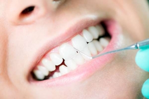 Teeth Cleaning: The Key to a Healthier Smile and Stronger Gums