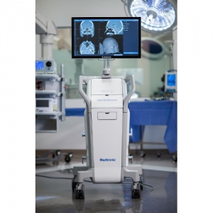 ENT Navigation System: Enhancing Precision in Ear, Nose, and Throat Surgeries