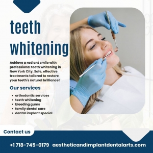 Are There At-Home Teeth Whitening Services in Brooklyn?