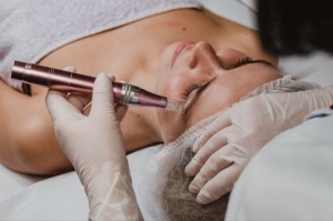 What is MNRF Treatment?