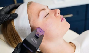 Timeless Radiance Awaits You with Morpheus8 Treatment in Dubai