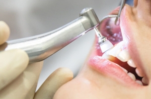When Does Seasonal Teeth Cleaning Cost in Dubai Drop?