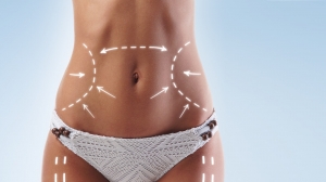 Snatch Every Angle with Ultra-Defined Liposuction Dubai