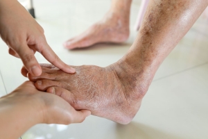 Why Is Daily Diabetic Foot Care at Home in Dubai Important?