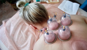 Explore Real Benefits of Hijama Treatment Cost in Dubai