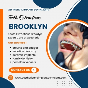 What to Eat After a Tooth Extraction in Brooklyn?