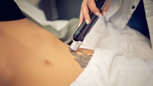 No More Ink Blues with Laser Tattoo Removal in Dubai